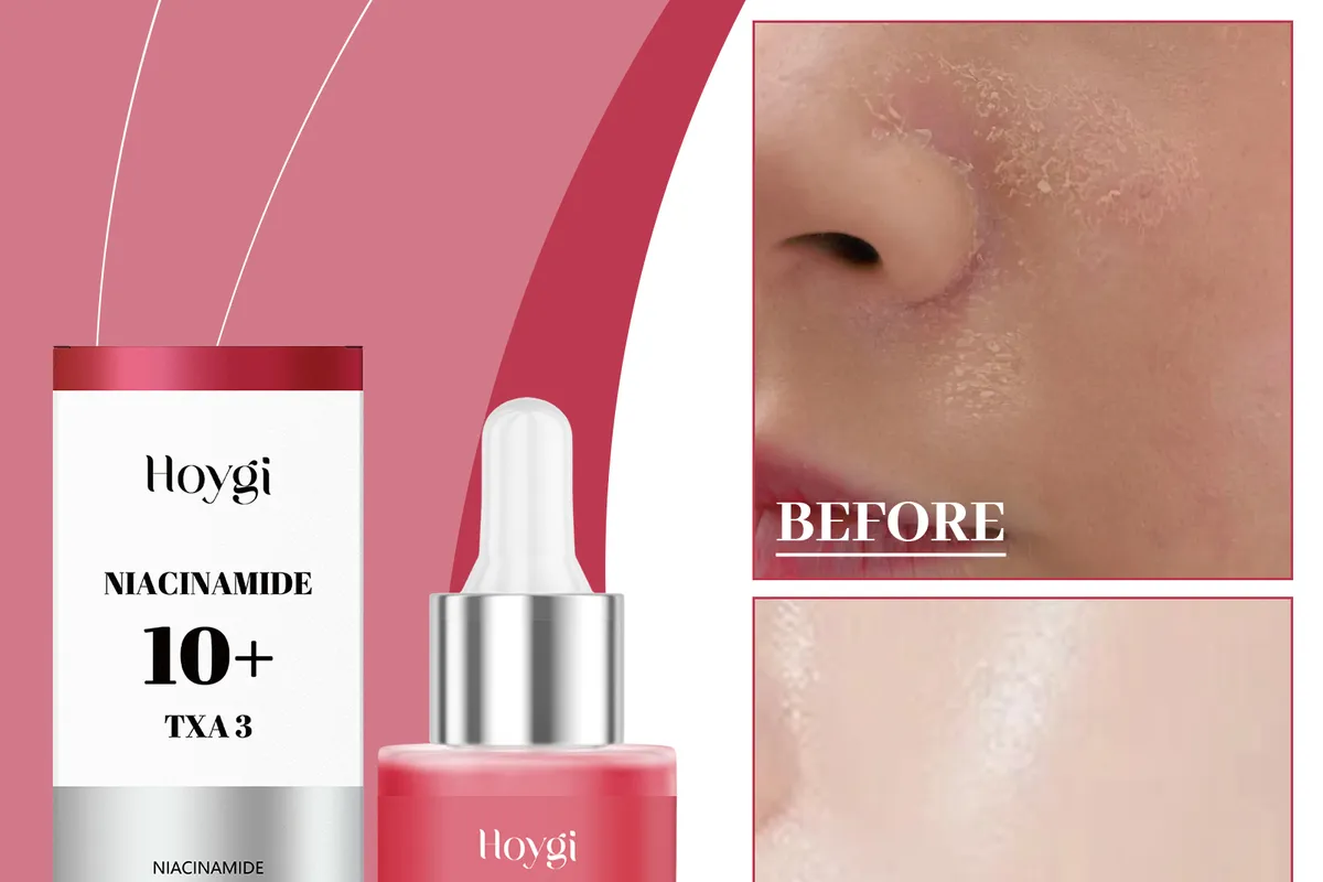 Hyaluronic Acid: The Hydration Hero