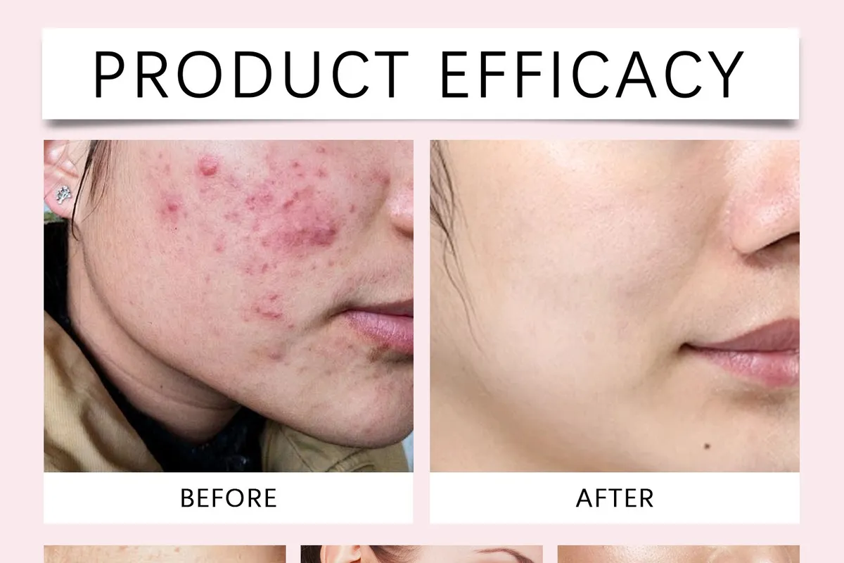 Build a Simple, Effective Skincare Routine in 4 Steps